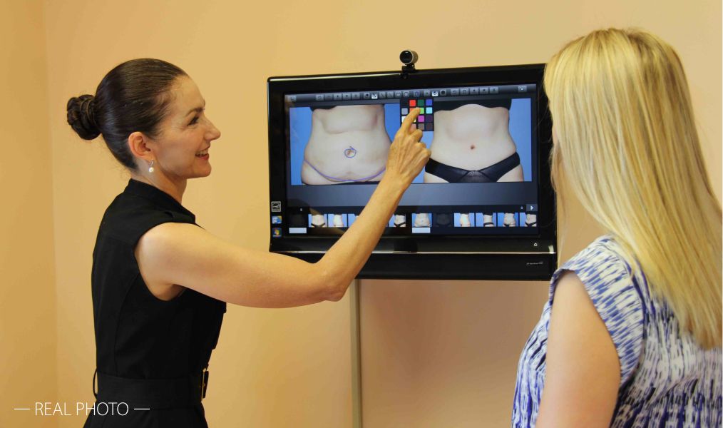 santa rosa plastic surgeon showing patient screen