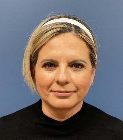 Facial Fat Transfer Before & After