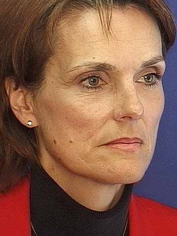 Brow Lift Before & After