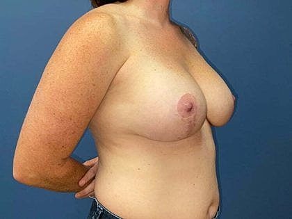 Female figure in profile against blue background.