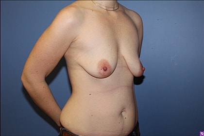 Body image side profile against blue background