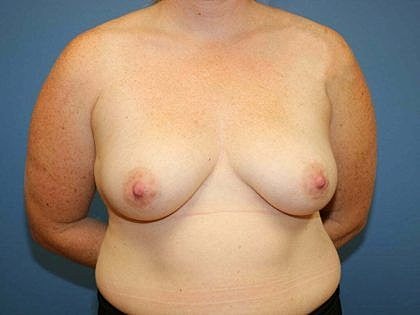 Bare torso against a blue background.