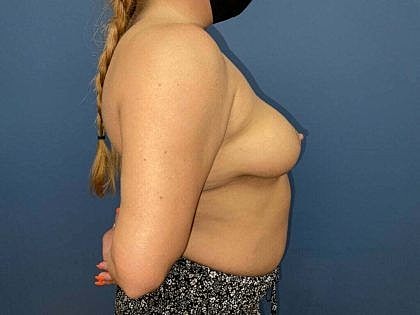 Profile view of person wearing a mask.