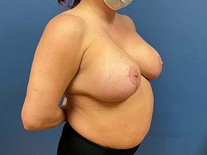 Woman in a mask posing for a side profile.