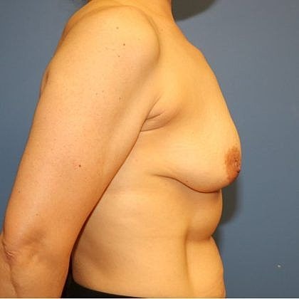 Profile view of a woman's torso.
